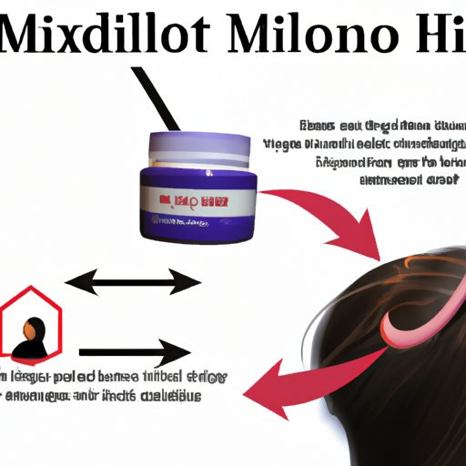 Understanding the Relationship Between Minoxidil and Hair Loss