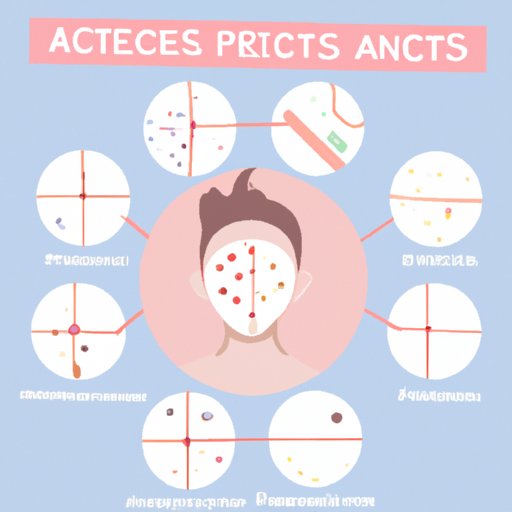 Comparing Different Types of Acne Patches