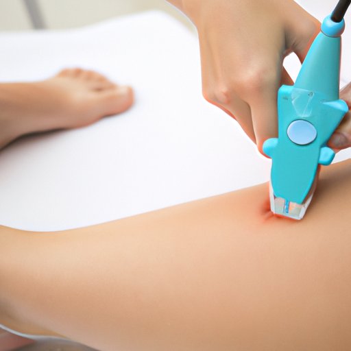 An Overview of Laser Hair Removal Brazilian Techniques