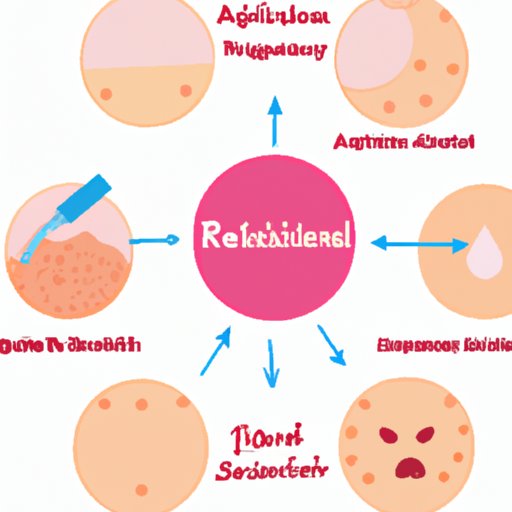 Do Retinoids Help Acne? A Comprehensive Guide to Retinoid Therapy - The 