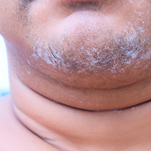 What Do Razor Bumps Look Like? An Overview of Symptoms, Causes, and Treatments