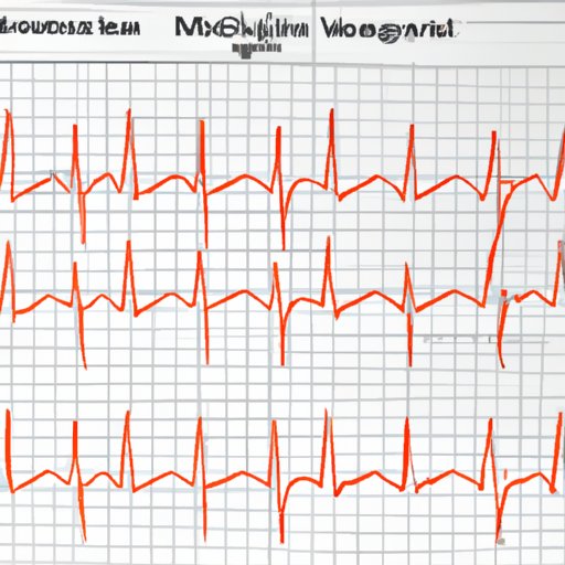 What is an Echo Cardio Gram? Exploring the Basics and Benefits